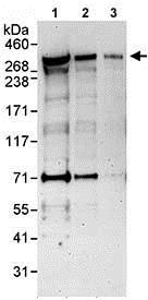 Western blot - Anti-ANKRD17 antibody (AB85726)