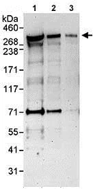 Western blot - Anti-ANKRD17 antibody (AB85726)