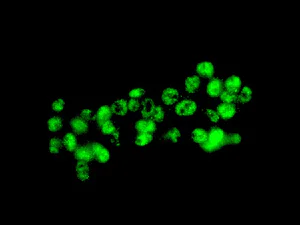 Immunocytochemistry/ Immunofluorescence - Anti-ANKRD2 antibody [EPR10731(B)] (AB151718)