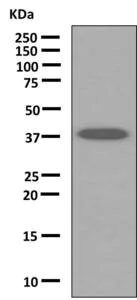Western blot - Anti-ANKRD2 antibody [EPR10731(B)] (AB151718)