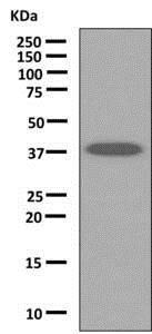 Western blot - Anti-ANKRD2 antibody [EPR10731(B)] - BSA and Azide free (AB249036)