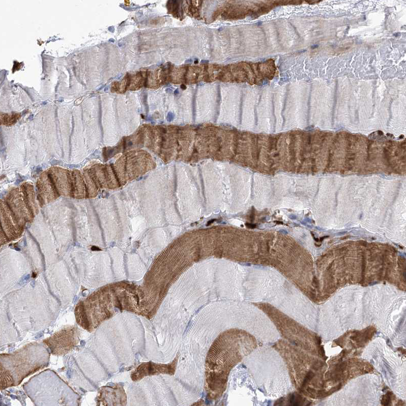 Immunohistochemistry (Formalin/PFA-fixed paraffin-embedded sections) - Anti-ANKRD23 antibody (AB122320), expandable thumbnail