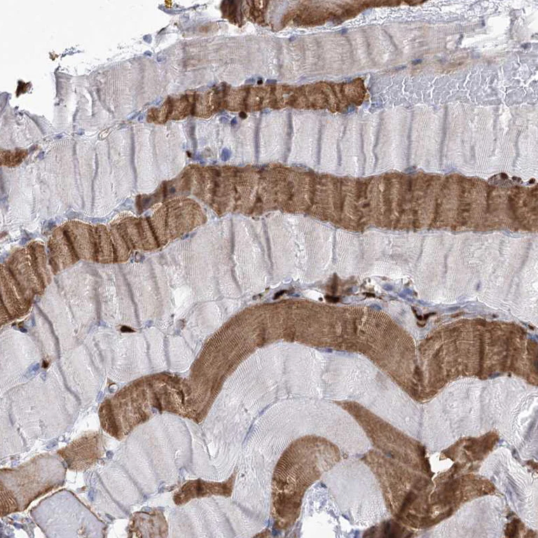 Immunohistochemistry (Formalin/PFA-fixed paraffin-embedded sections) - Anti-ANKRD23 antibody (AB122320)