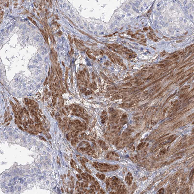 Immunohistochemistry (Formalin/PFA-fixed paraffin-embedded sections) - Anti-ANKRD23 antibody (AB122320), expandable thumbnail