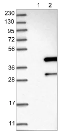 Western blot - Anti-ANKRD23 antibody (AB122320)