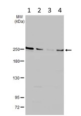 Western blot - Anti-Ankrd26 antibody (AB183846)
