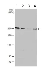Western blot - Anti-Ankrd26 antibody (AB183846)