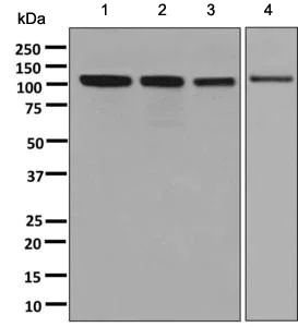 Western blot - Anti-ANKRD28 antibody [EPR9211] (AB137091)