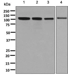 Western blot - Anti-ANKRD28 antibody [EPR9211] - BSA and Azide free (AB248814)