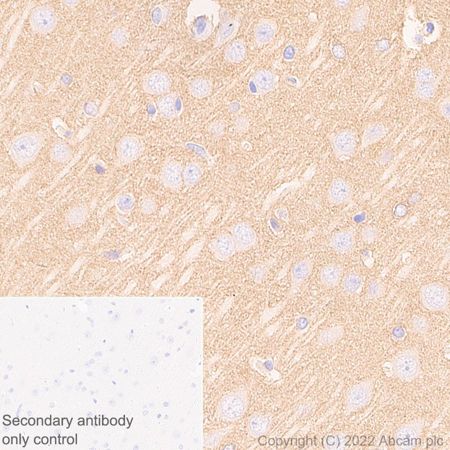 Immunohistochemistry (Formalin/PFA-fixed paraffin-embedded sections) - Anti-Ankyrin-B antibody [EPR26550-85] - BSA and Azide free (AB307415), expandable thumbnail
