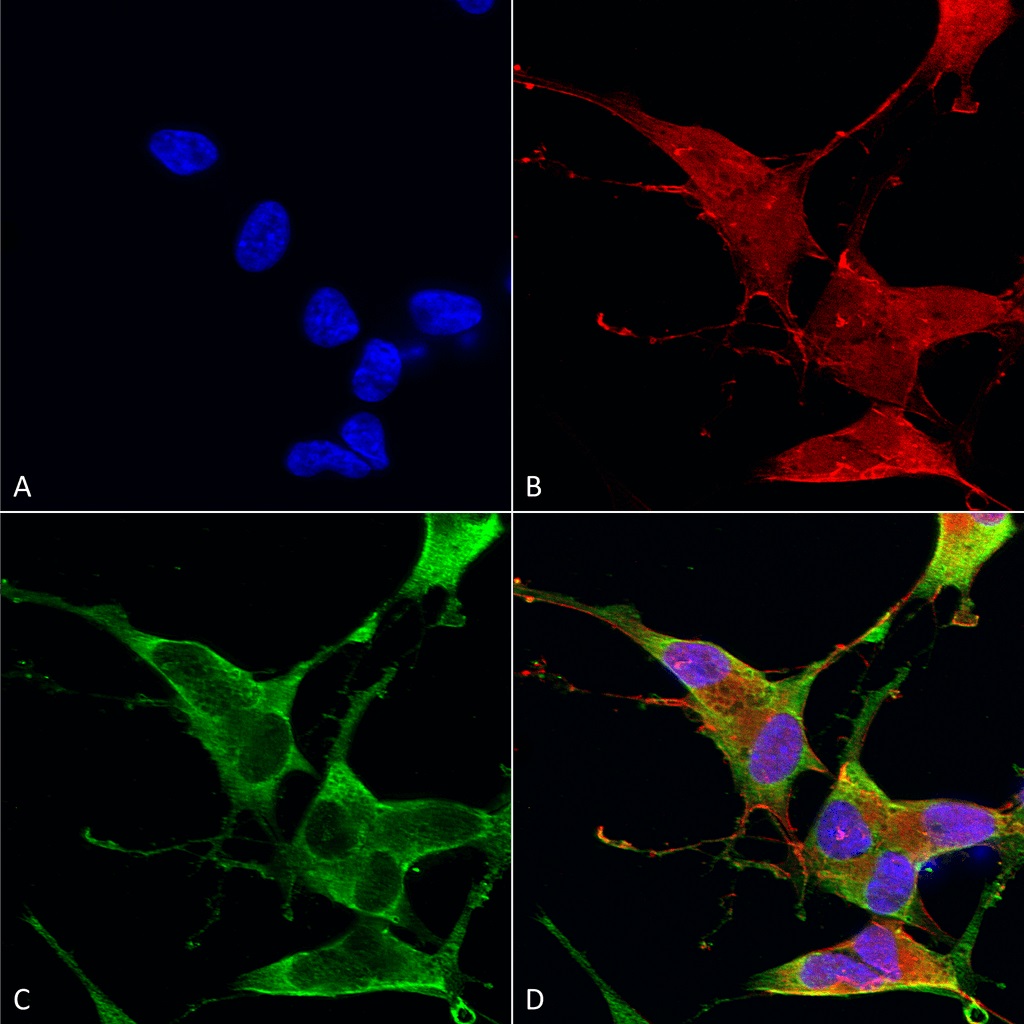 Immunocytochemistry/ Immunofluorescence - Anti-Ankyrin erythroid/ANK antibody [S388A-10] (AB212053)