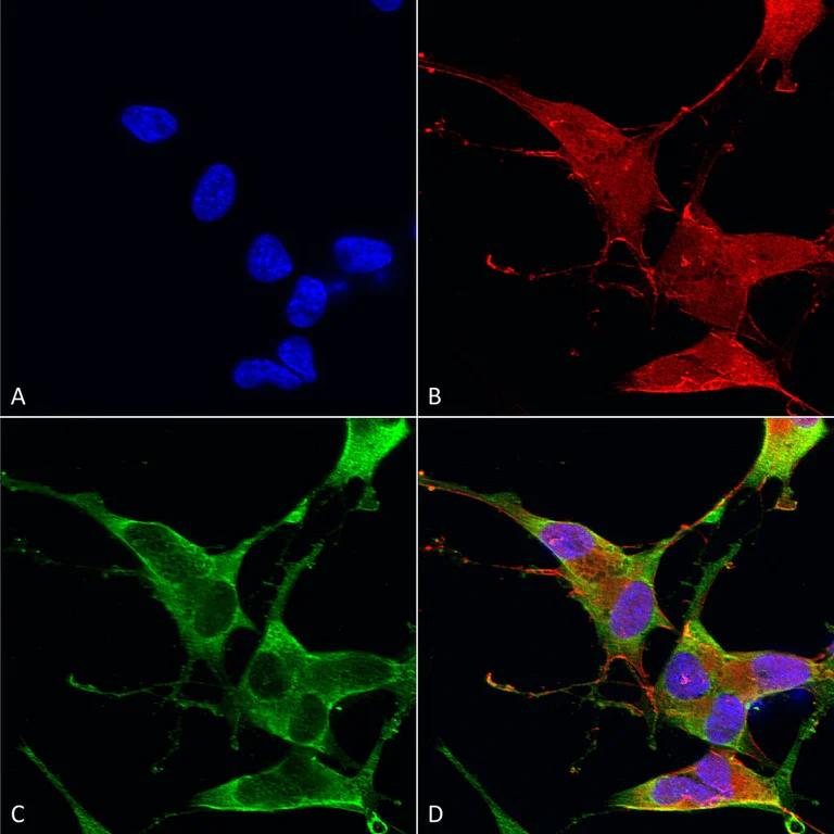 Immunocytochemistry/ Immunofluorescence - Anti-Ankyrin erythroid/ANK antibody [S388A-10] (AB212053)