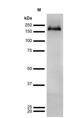 Western blot - Anti-Ankyrin erythroid/ANK antibody [S388A-10] (AB212053)