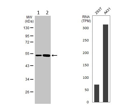 Western blot - Anti-Annexin-11/ANXA11 antibody (AB137424)