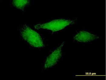 Immunocytochemistry/ Immunofluorescence - Anti-Annexin-11/ANXA11 antibody (AB166846), expandable thumbnail