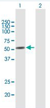 Western blot - Anti-Annexin-11/ANXA11 antibody (AB166846), expandable thumbnail