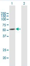 Western blot - Anti-Annexin-11/ANXA11 antibody (AB166846)
