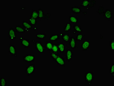 Immunocytochemistry/ Immunofluorescence - Anti-Annexin-11/ANXA11 antibody (AB236599)