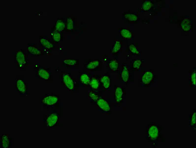 Immunocytochemistry/ Immunofluorescence - Anti-Annexin-11/ANXA11 antibody (AB236599)