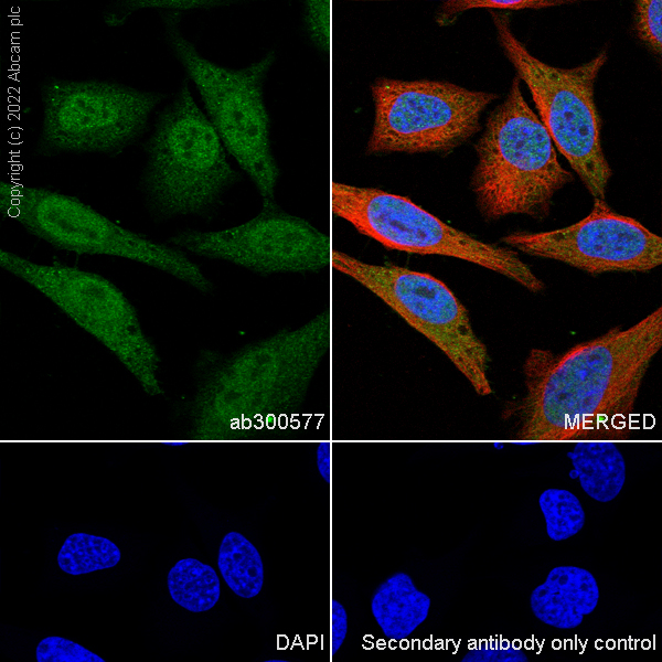 Immunocytochemistry/ Immunofluorescence - Anti-Annexin-11/ANXA11 antibody [EPR26004-63] (AB300577)