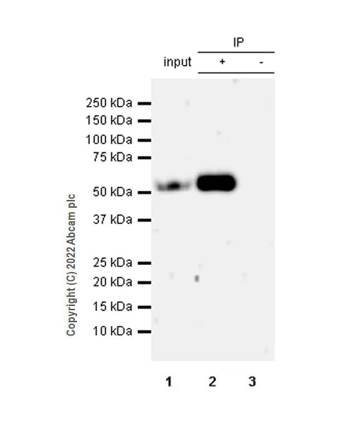 Immunoprecipitation - Anti-Annexin-11/ANXA11 antibody [EPR26004-63] (AB300577)