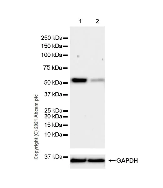 Western blot - Anti-Annexin-11/ANXA11 antibody [EPR26004-63] (AB300577)