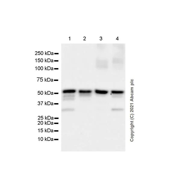 Western blot - Anti-Annexin-11/ANXA11 antibody [EPR26004-63] (AB300577)