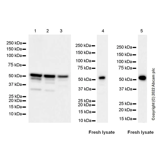 Western blot - Anti-Annexin-11/ANXA11 antibody [EPR26004-63] (BSA and Azide free) (AB300578)
