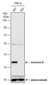 Western blot - Anti-Annexin-2/ANXA2 antibody (AB154113)