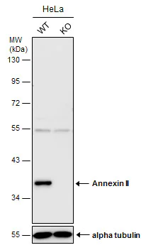 Western blot - Anti-Annexin-2/ANXA2 antibody (AB154113)