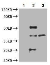 Immunoprecipitation - Anti-Annexin-2/ANXA2 antibody (AB235939)