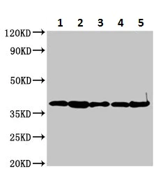 Western blot - Anti-Annexin-2/ANXA2 antibody (AB235939)