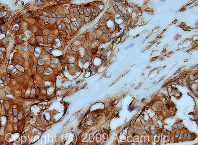 Immunohistochemistry (Formalin/PFA-fixed paraffin-embedded sections) - Anti-Annexin-2/ANXA2 antibody (AB41803)