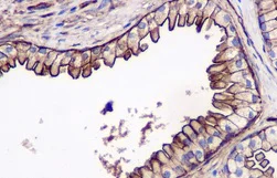 Immunohistochemistry (Formalin/PFA-fixed paraffin-embedded sections) - Anti-Annexin-2/ANXA2 antibody [EPR13052(B)] (AB178677)
