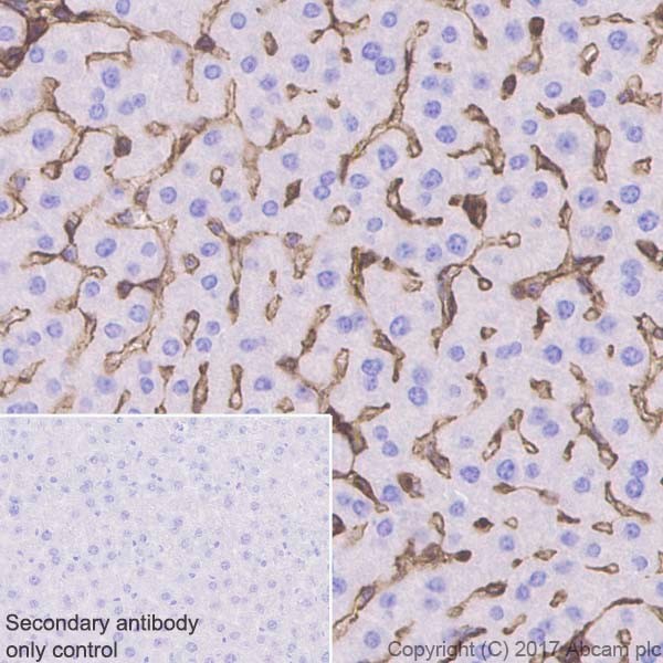 Immunohistochemistry (Formalin/PFA-fixed paraffin-embedded sections) - Anti-Annexin-2/ANXA2 antibody [EPR18157-104] (AB189473), expandable thumbnail