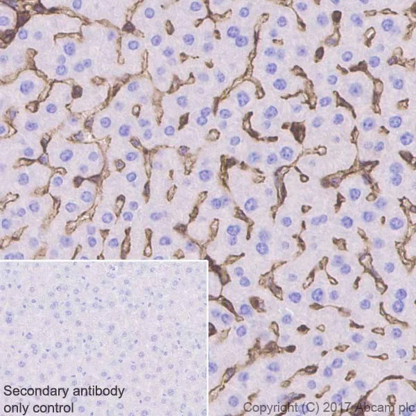 Immunohistochemistry (Formalin/PFA-fixed paraffin-embedded sections) - Anti-Annexin-2/ANXA2 antibody [EPR18157-104] (AB189473)