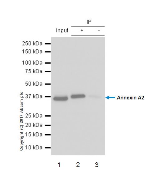 Immunoprecipitation - Anti-Annexin-2/ANXA2 antibody [EPR18157-104] (AB189473), expandable thumbnail