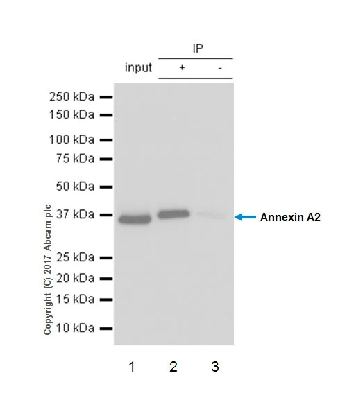Immunoprecipitation - Anti-Annexin-2/ANXA2 antibody [EPR18157-104] - BSA and Azide free (AB227486)