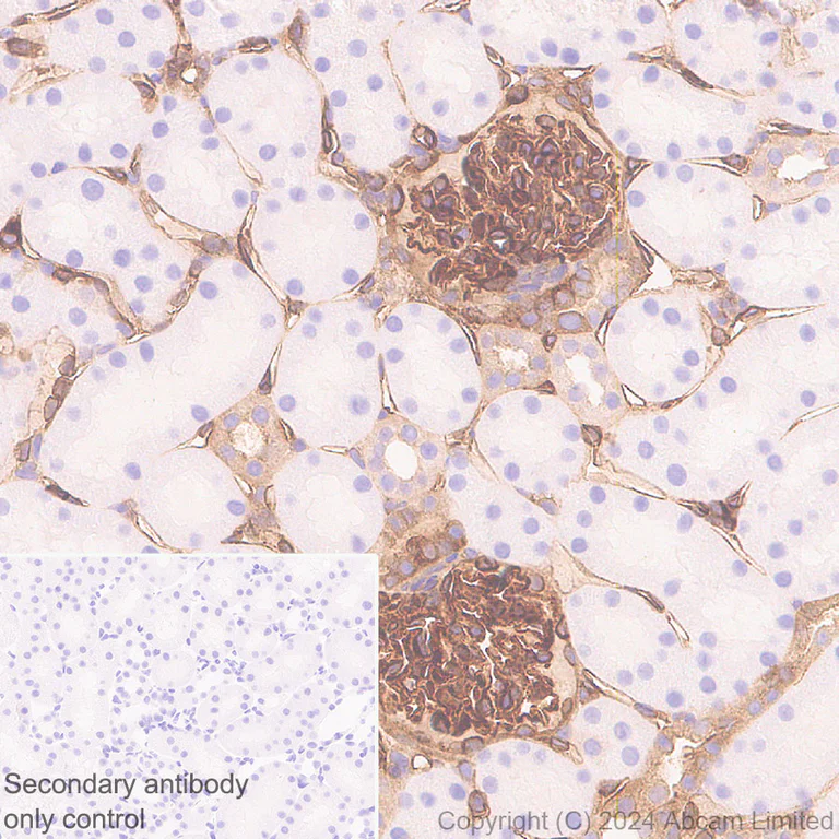 Immunohistochemistry (Formalin/PFA-fixed paraffin-embedded sections) - Anti-Annexin-2/ANXA2 antibody [RM1229] (AB321903)