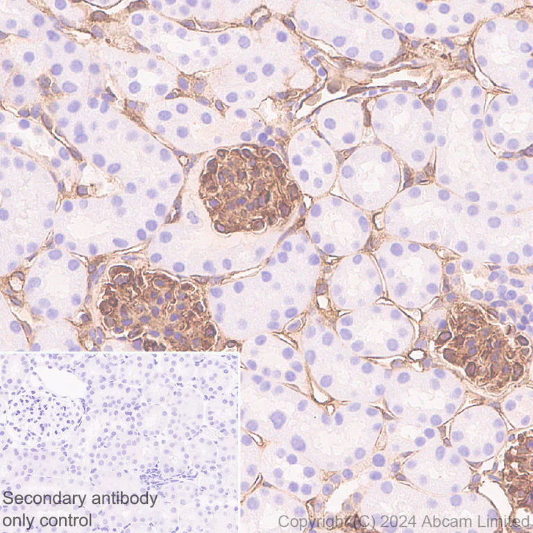 Immunohistochemistry (Formalin/PFA-fixed paraffin-embedded sections) - Anti-Annexin-2/ANXA2 antibody [RM1229] - BSA and Azide free (AB321904)