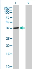 Western blot - Annexin-2/ANXA2 overexpression 293T lysate (whole cell) (AB94080)