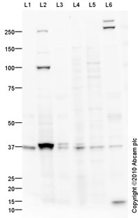 Annexin-2/ANXA2 overexpression 293T lysate (whole cell)