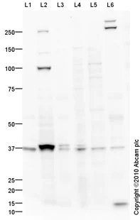 Western blot - Annexin-2/ANXA2 overexpression 293T lysate (whole cell) (AB94080)