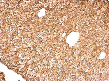 Immunohistochemistry (Formalin/PFA-fixed paraffin-embedded sections) - Anti-Annexin-4/ANXA4 antibody (AB153883)