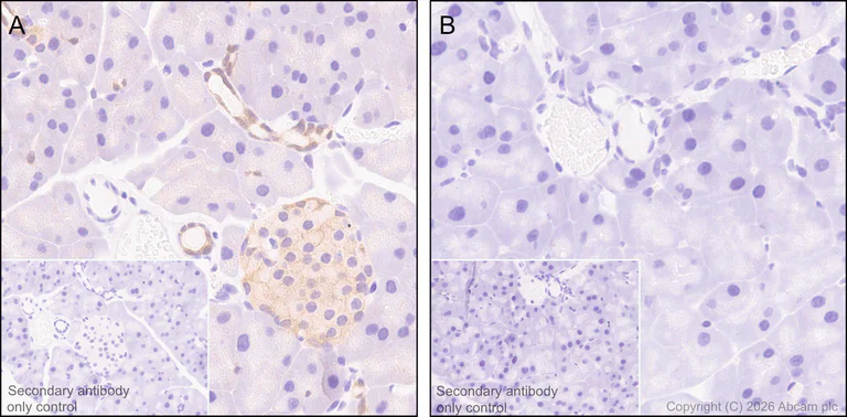 Immunohistochemistry (Formalin/PFA-fixed paraffin-embedded sections) - Anti-Annexin-4/ANXA4 antibody [EPR22929-208] (AB256456)