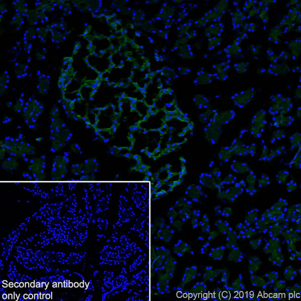 Anti-Annexin-4/ANXA4 antibody [EPR22929-208] (ab256456) | Abcam