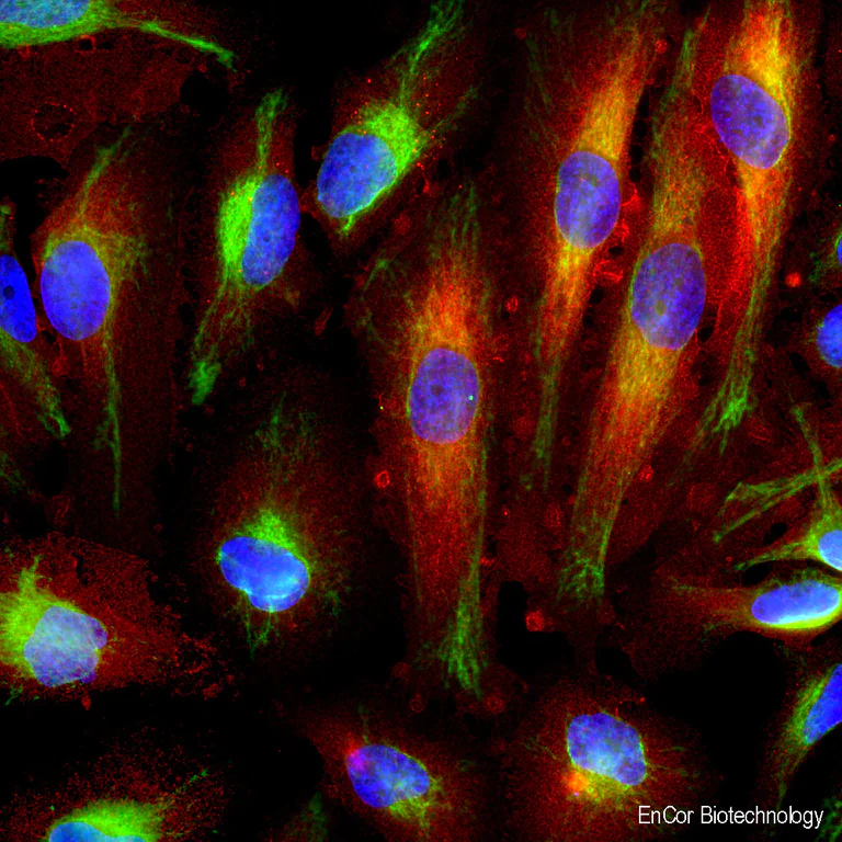 Immunocytochemistry/ Immunofluorescence - Anti-Annexin-6/ANXA6 antibody [4G3] (AB315196)