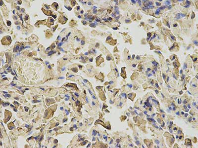 Immunohistochemistry (Formalin/PFA-fixed paraffin-embedded sections) - Anti-Annexin-6/ANXA6 antibody (AB196942)