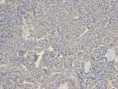 Immunohistochemistry (Formalin/PFA-fixed paraffin-embedded sections) - Anti-Annexin-6/ANXA6 antibody (AB196942)