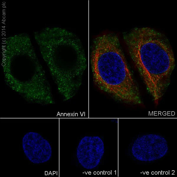 Immunocytochemistry/ Immunofluorescence - Anti-Annexin-6/ANXA6 antibody [EPR17308] - BSA and Azide free (AB251272)
